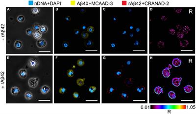 The effect of human PBMCs immobilization on their Аβ42 aggregates-dependent proinflammatory state on a cellular model of Alzheimer’s disease